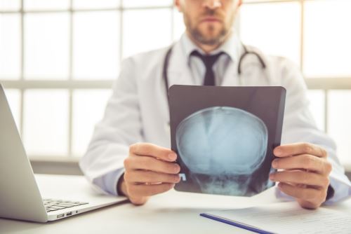 The Most Common Types of Brain Injuries